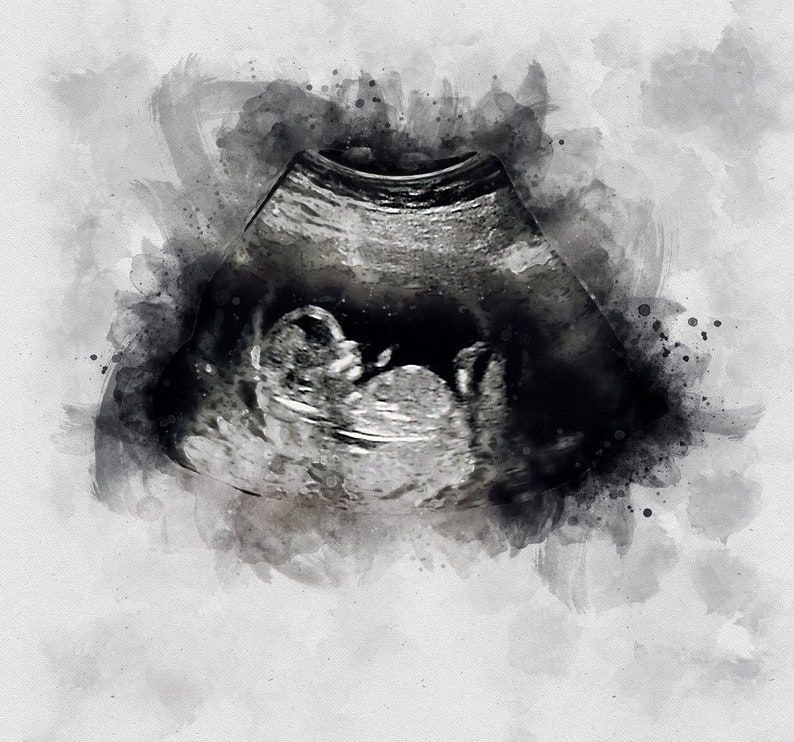 Sonogram Art - Pregnancy Gifts