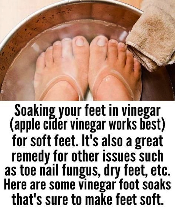 Antibacterial apple cider vinegar foot soak