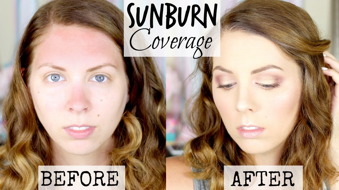 Sunburn coverage tutorial